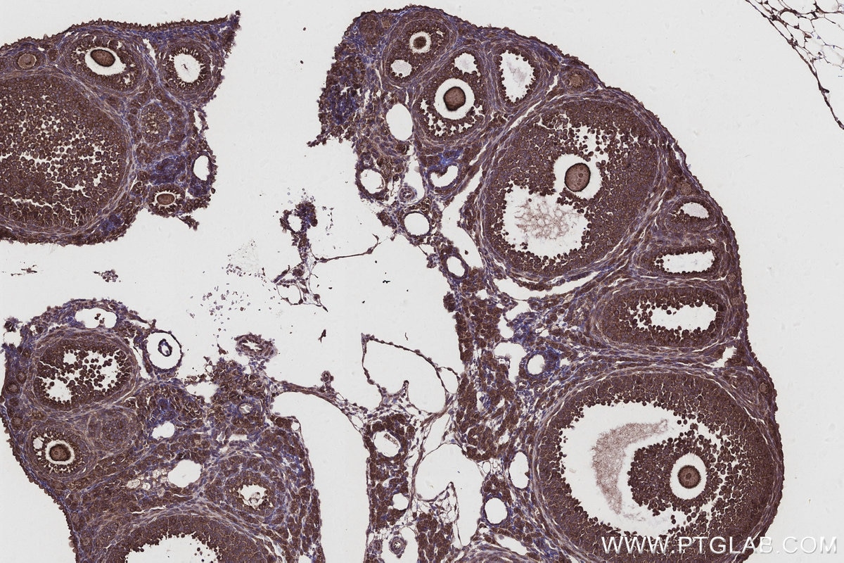 Immunohistochemistry (IHC) staining of mouse ovary tissue using CNOT10 Polyclonal antibody (15938-1-AP)