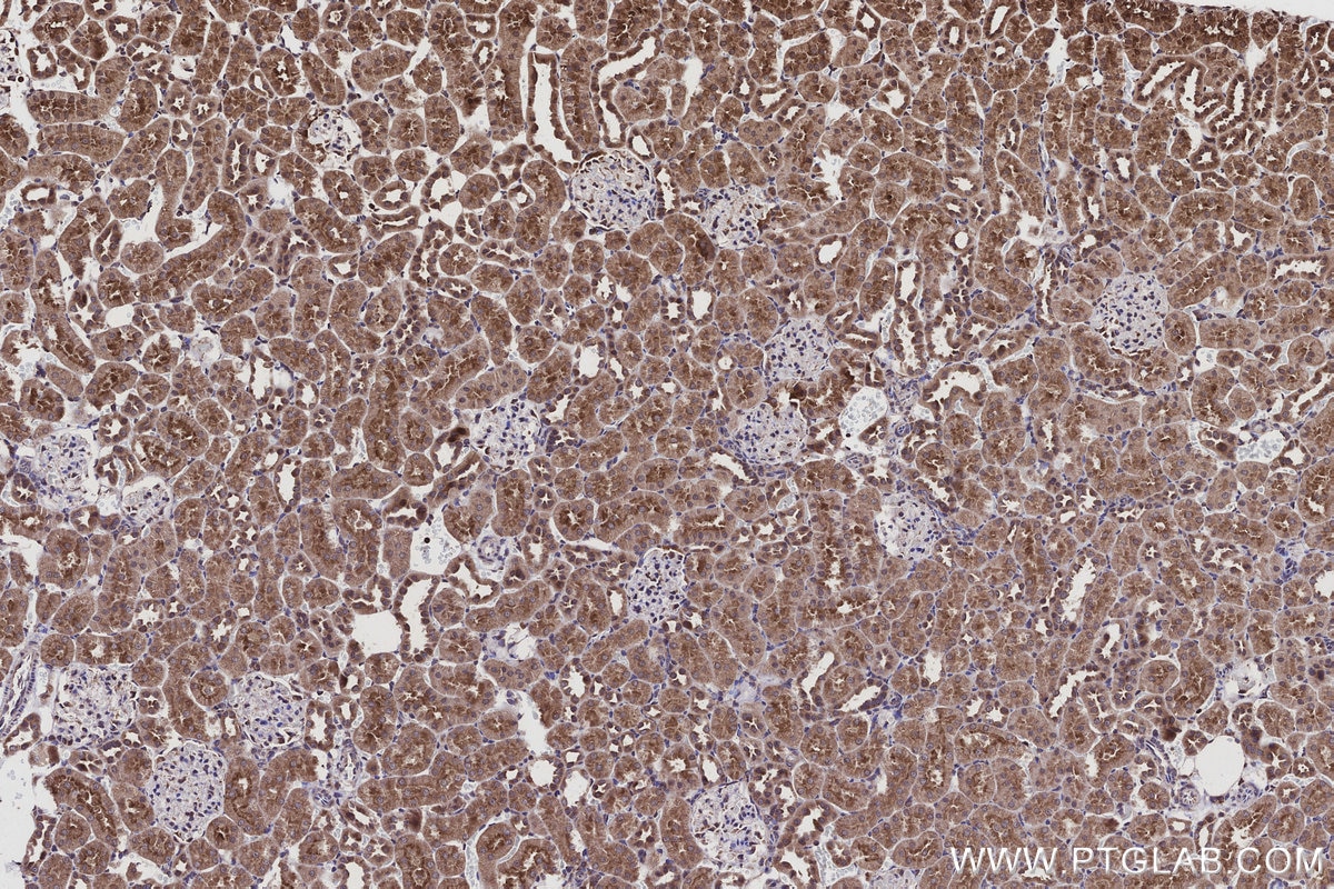Immunohistochemistry (IHC) staining of rat kidney tissue using CNOT10 Polyclonal antibody (15938-1-AP)