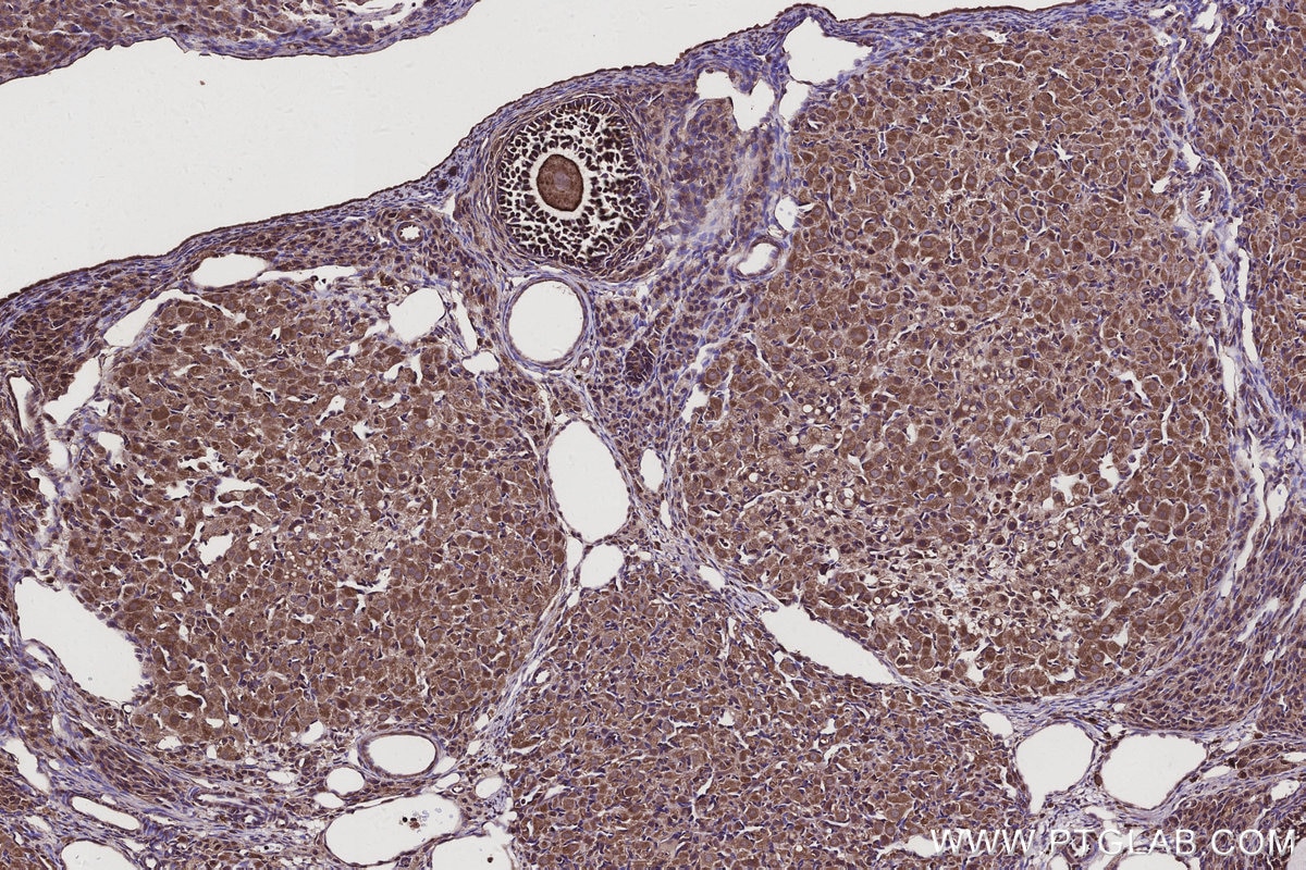 Immunohistochemistry (IHC) staining of rat ovary tissue using CNOT10 Polyclonal antibody (15938-1-AP)
