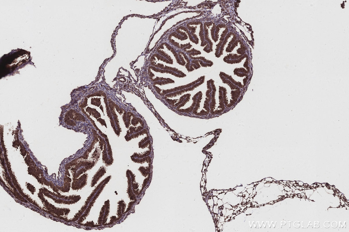 Immunohistochemistry (IHC) staining of mouse ovary tissue using CNOT10 Polyclonal antibody (15938-1-AP)
