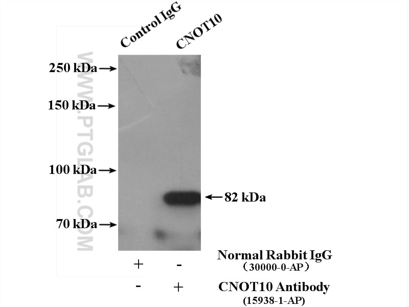 Immunoprecipitation (IP) experiment of mouse brain tissue using CNOT10 Polyclonal antibody (15938-1-AP)