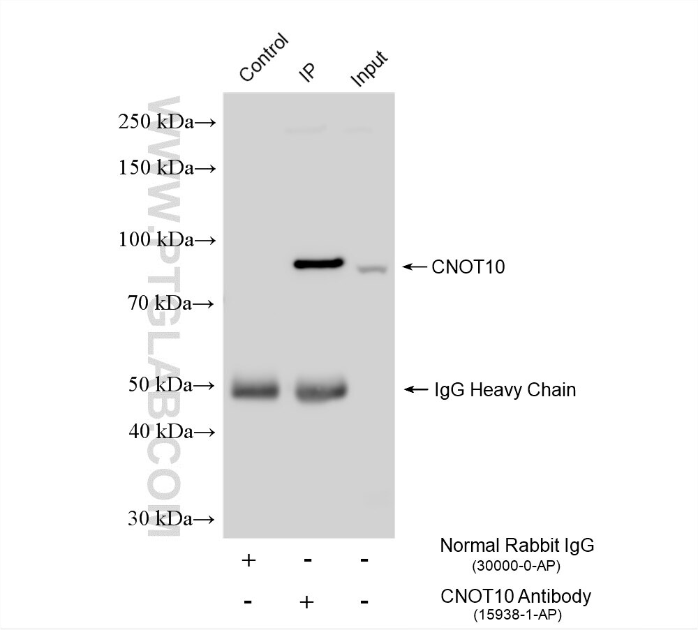 Immunoprecipitation (IP) experiment of HeLa cells using CNOT10 Polyclonal antibody (15938-1-AP)