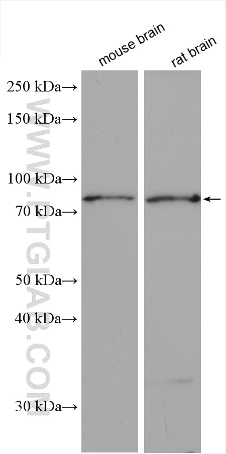 Western Blot (WB) analysis of various lysates using CNOT10 Polyclonal antibody (15938-1-AP)