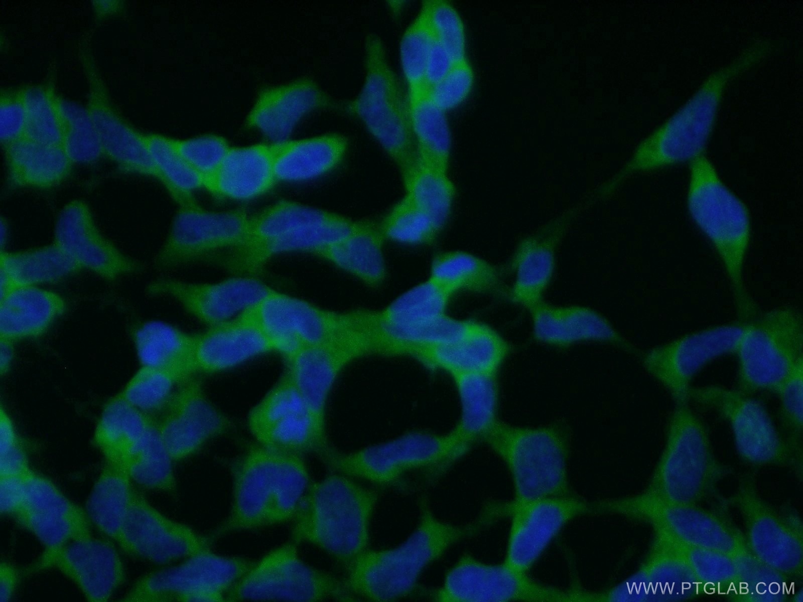 Immunofluorescence (IF) / fluorescent staining of HEK-293 cells using CNOT2 Polyclonal antibody (10313-1-AP)