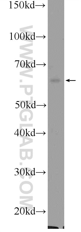 CNOT2 Polyclonal antibody