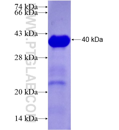 CNOT2 fusion protein Ag28215 SDS-PAGE