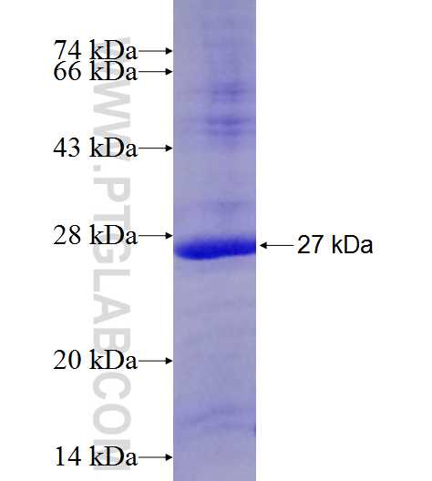 CNOT2 fusion protein Ag20553 SDS-PAGE