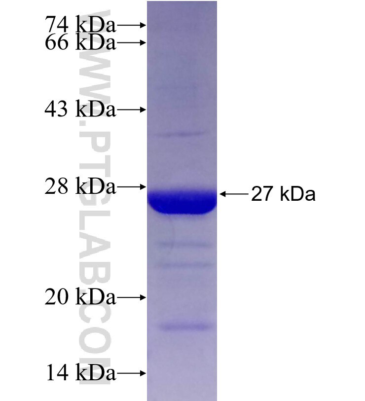 CNOT2 fusion protein Ag20553 SDS-PAGE