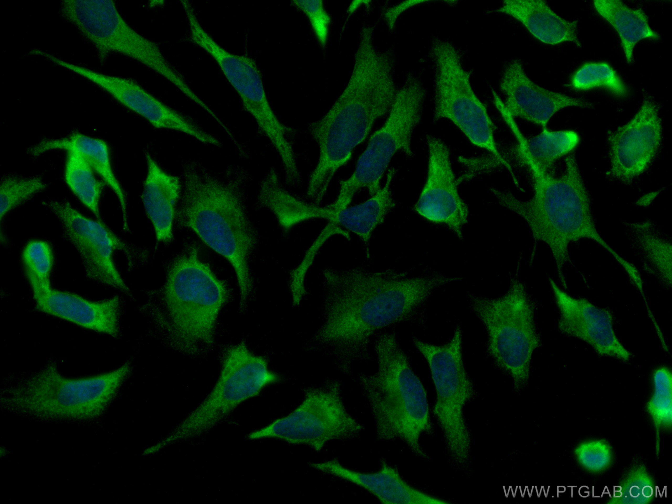 Immunofluorescence (IF) / fluorescent staining of HeLa cells using CNOT3 Polyclonal antibody (11135-1-AP)