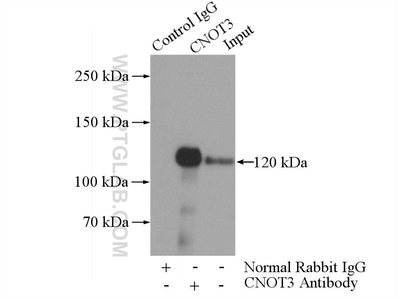 Immunoprecipitation (IP) experiment of HeLa cells using CNOT3 Polyclonal antibody (11135-1-AP)