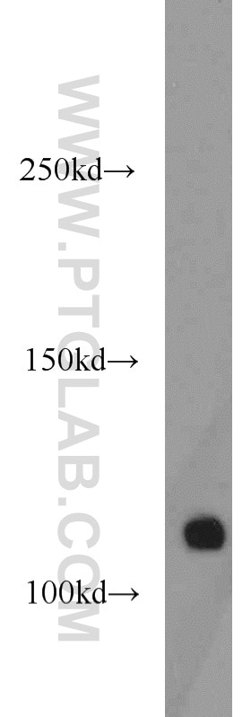 Western Blot (WB) analysis of K-562 cells using CNOT3 Polyclonal antibody (11135-1-AP)