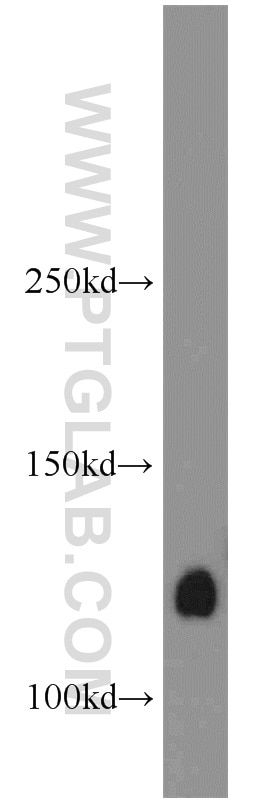 Western Blot (WB) analysis of Raji cells using CNOT3 Polyclonal antibody (11135-1-AP)