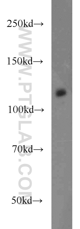 Western Blot (WB) analysis of HT-1080 cells using CNOT3 Polyclonal antibody (11135-1-AP)