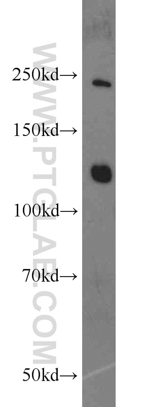 Western Blot (WB) analysis of mouse brain tissue using CNOT3 Polyclonal antibody (11135-1-AP)