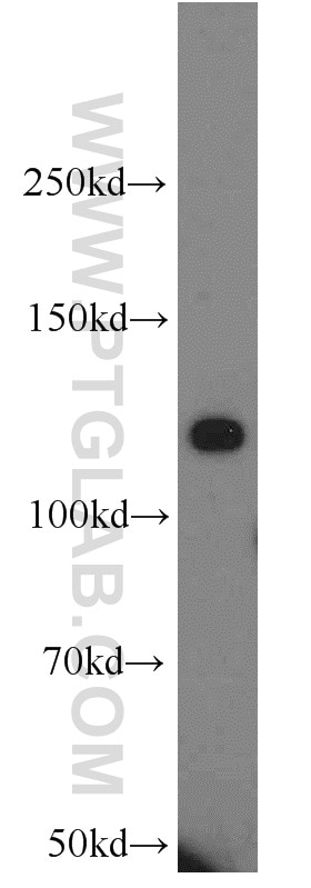 Western Blot (WB) analysis of HEK-293 cells using CNOT3 Polyclonal antibody (11135-1-AP)