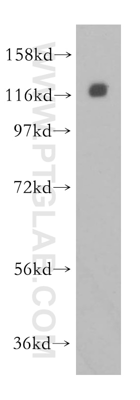 Western Blot (WB) analysis of human brain tissue using CNOT3 Polyclonal antibody (11135-1-AP)