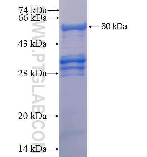 CNOT3 fusion protein Ag1587 SDS-PAGE