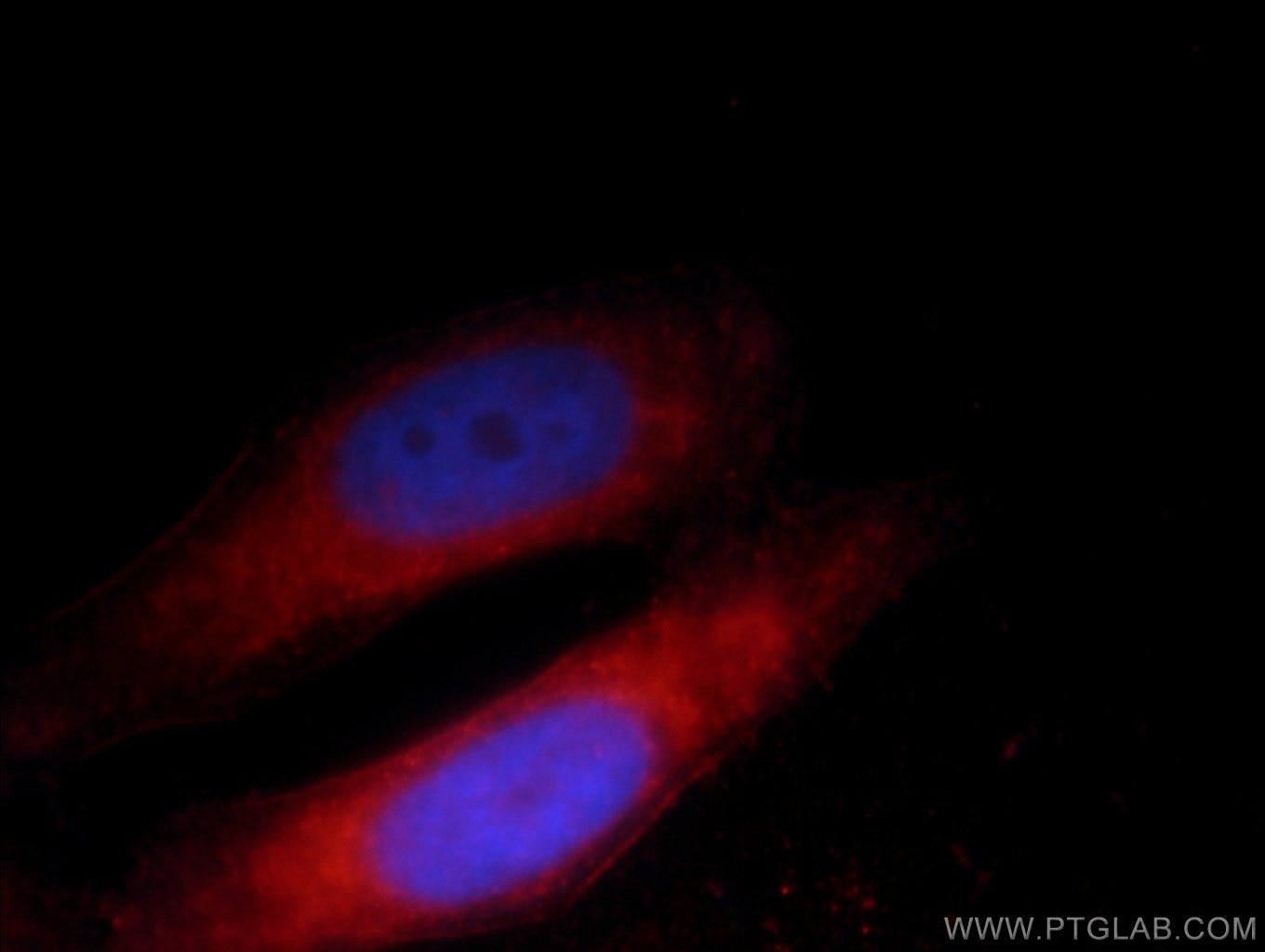 Immunofluorescence (IF) / fluorescent staining of HepG2 cells using CNOT4 Polyclonal antibody (12564-1-AP)