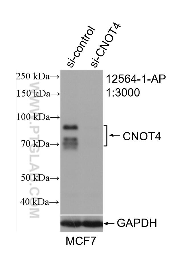 Western Blot (WB) analysis of MCF-7 cells using CNOT4 Polyclonal antibody (12564-1-AP)