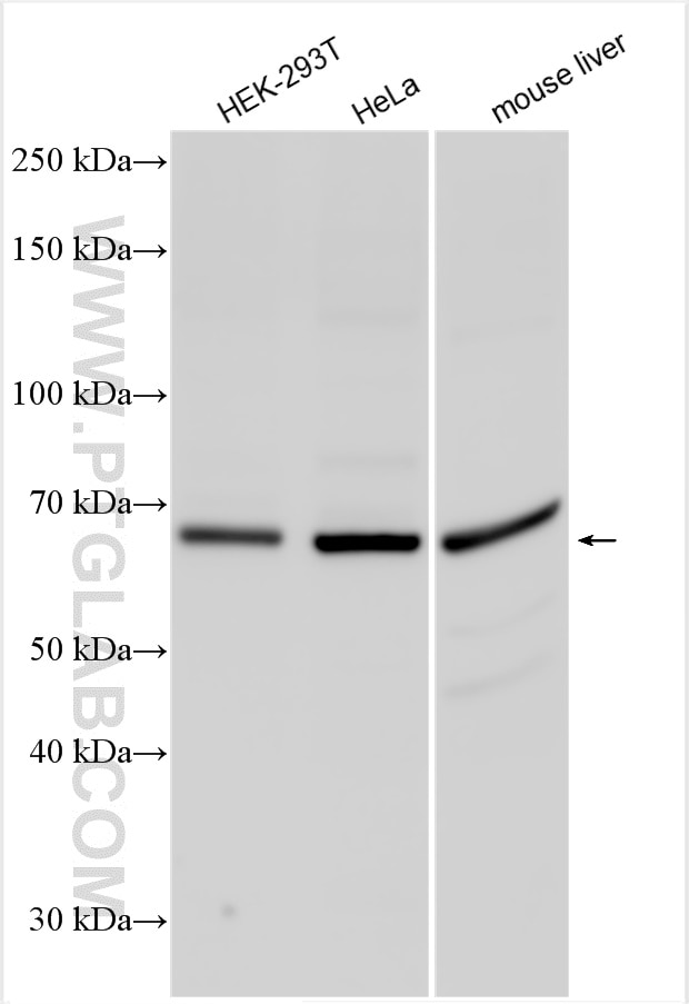 Western Blot (WB) analysis of various lysates using CNOT4 Polyclonal antibody (12564-1-AP)