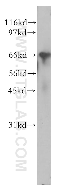 Western Blot (WB) analysis of mouse testis tissue using CNOT4 Polyclonal antibody (12564-1-AP)
