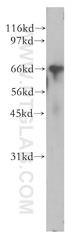 WB analysis of mouse testis using 12564-1-AP