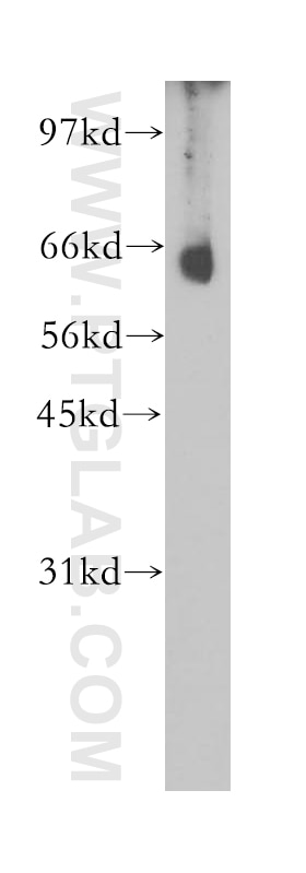 Western Blot (WB) analysis of mouse skeletal muscle tissue using CNOT4 Polyclonal antibody (12564-1-AP)