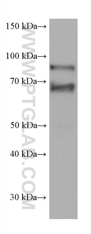 Western Blot (WB) analysis of U2OS cells using CNOT4 Monoclonal antibody (67798-1-Ig)
