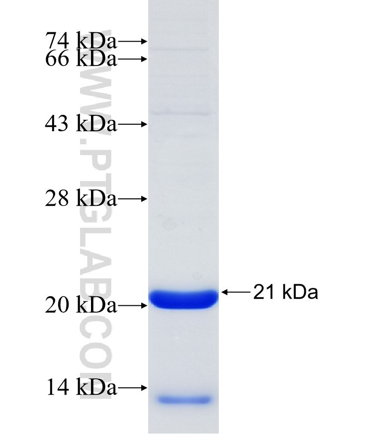 CNOT4 fusion protein Ag30968 SDS-PAGE CNOT4 fusion protein Ag30968 SDS-PAGE