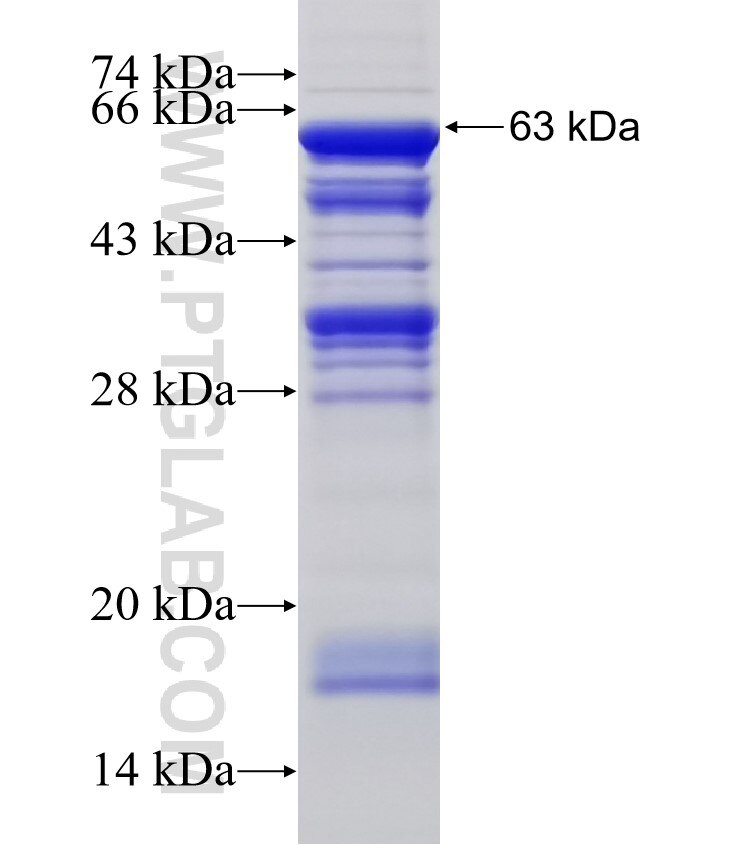 CNOT4 fusion protein Ag3163 SDS-PAGE