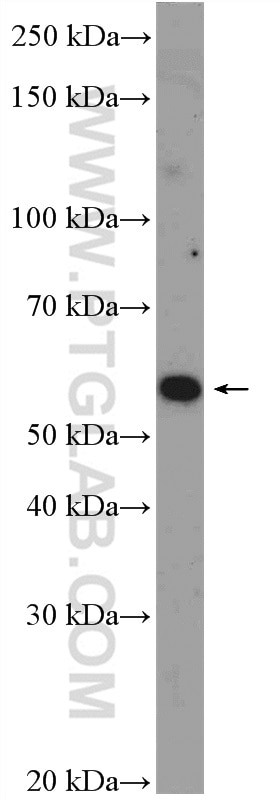 Western Blot (WB) analysis of Jurkat cells using CNOT6 Polyclonal antibody (17935-1-AP)