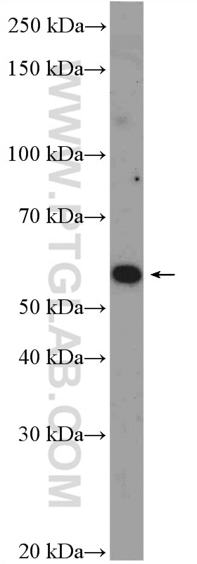 WB analysis of Jurkat using 17935-1-AP