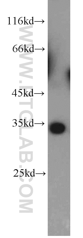 Western Blot (WB) analysis of mouse testis tissue using CNOT7 Polyclonal antibody (14102-1-AP)