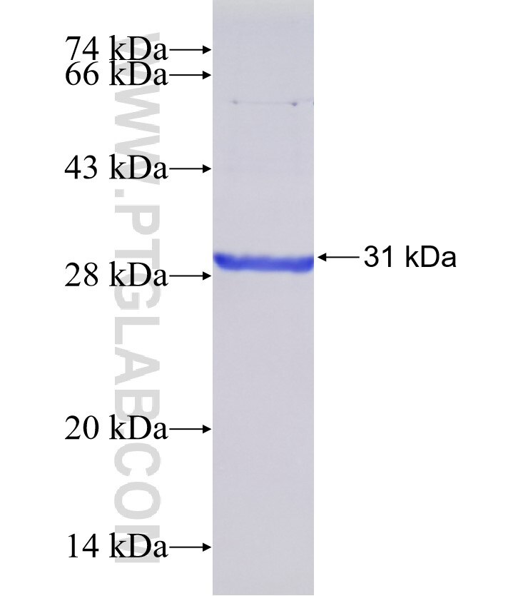CNOT7 fusion protein Ag24053 SDS-PAGE