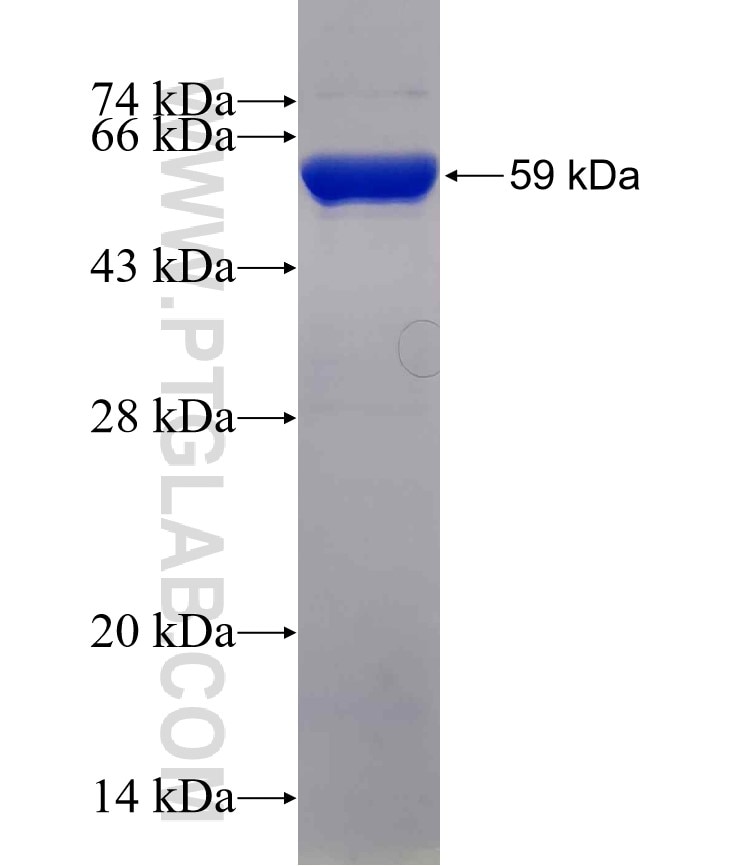 CNOT7 fusion protein Ag5235 SDS-PAGE