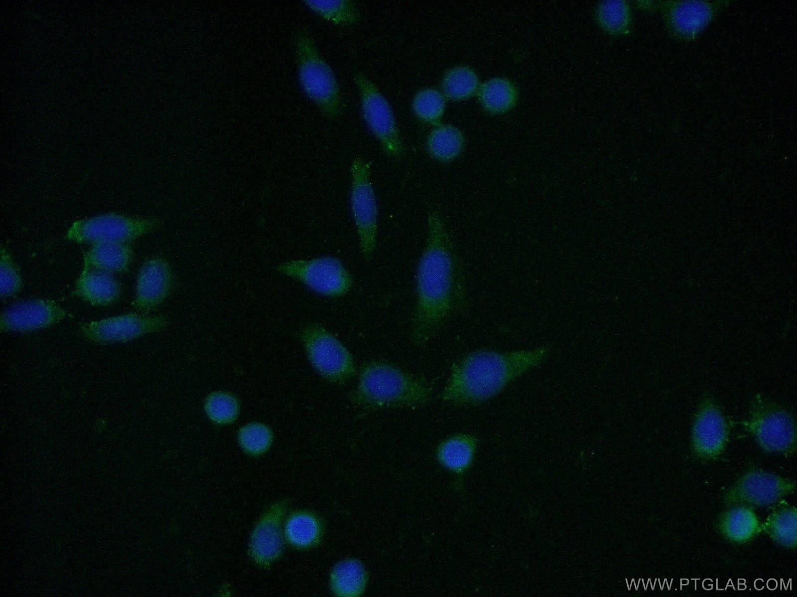 Immunofluorescence (IF) / fluorescent staining of HeLa cells using CNOT8 Polyclonal antibody (10752-1-AP)