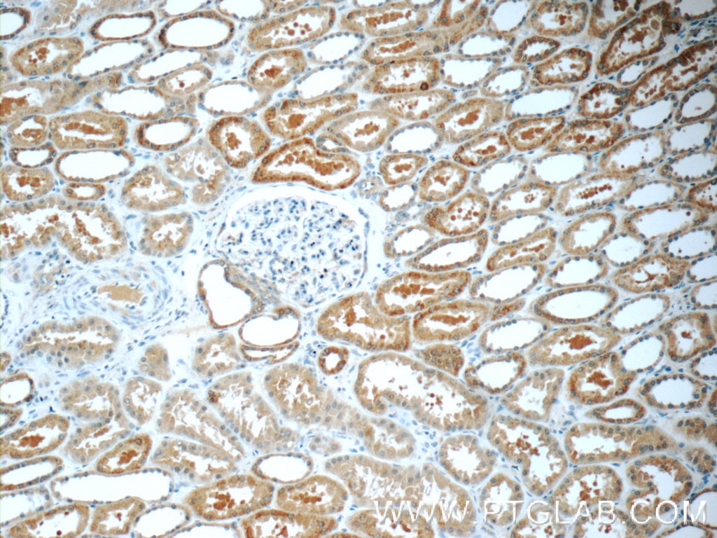 Immunohistochemistry (IHC) staining of human kidney tissue using CNOT8 Polyclonal antibody (10752-1-AP)