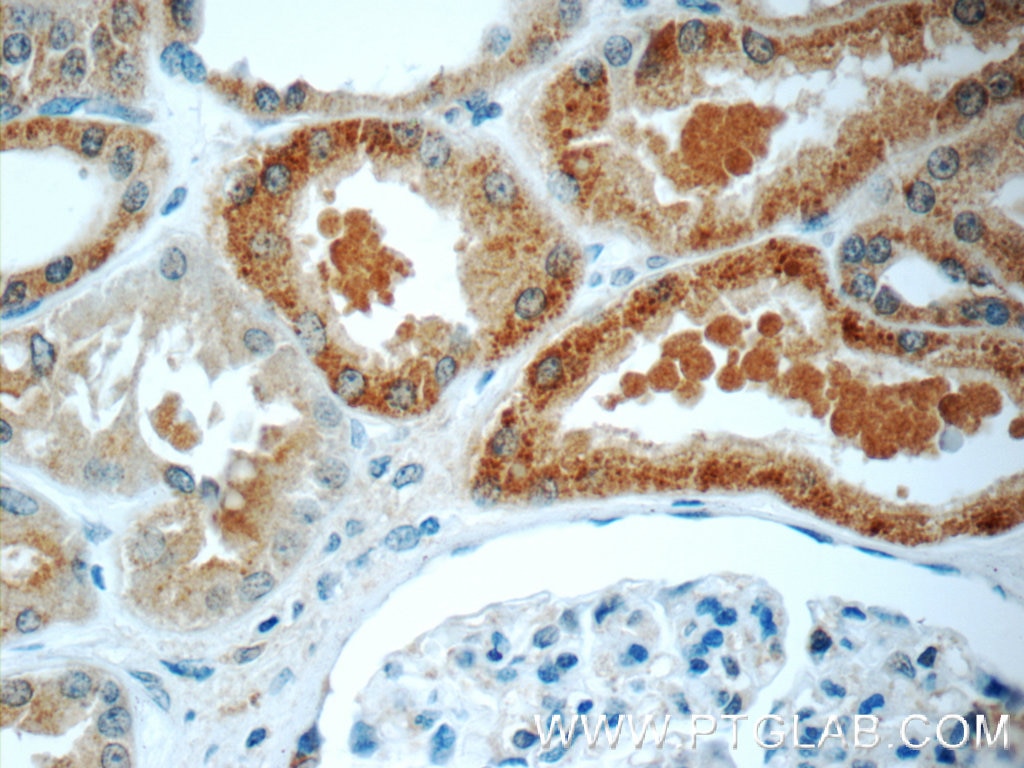 Immunohistochemistry (IHC) staining of human kidney tissue using CNOT8 Polyclonal antibody (10752-1-AP)
