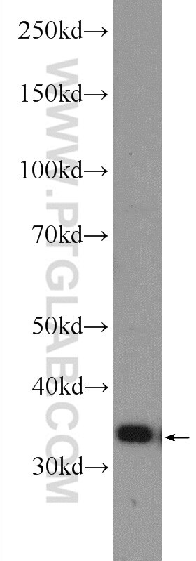 Western Blot (WB) analysis of mouse testis tissue using CNOT8 Polyclonal antibody (10752-1-AP)