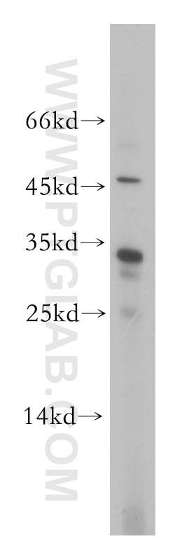 Western Blot (WB) analysis of Jurkat cells using CNOT8 Polyclonal antibody (10752-1-AP)