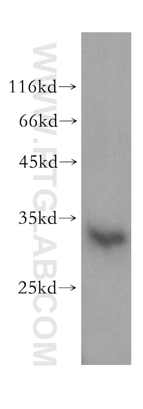 Western Blot (WB) analysis of HeLa cells using CNOT8 Polyclonal antibody (10752-1-AP)