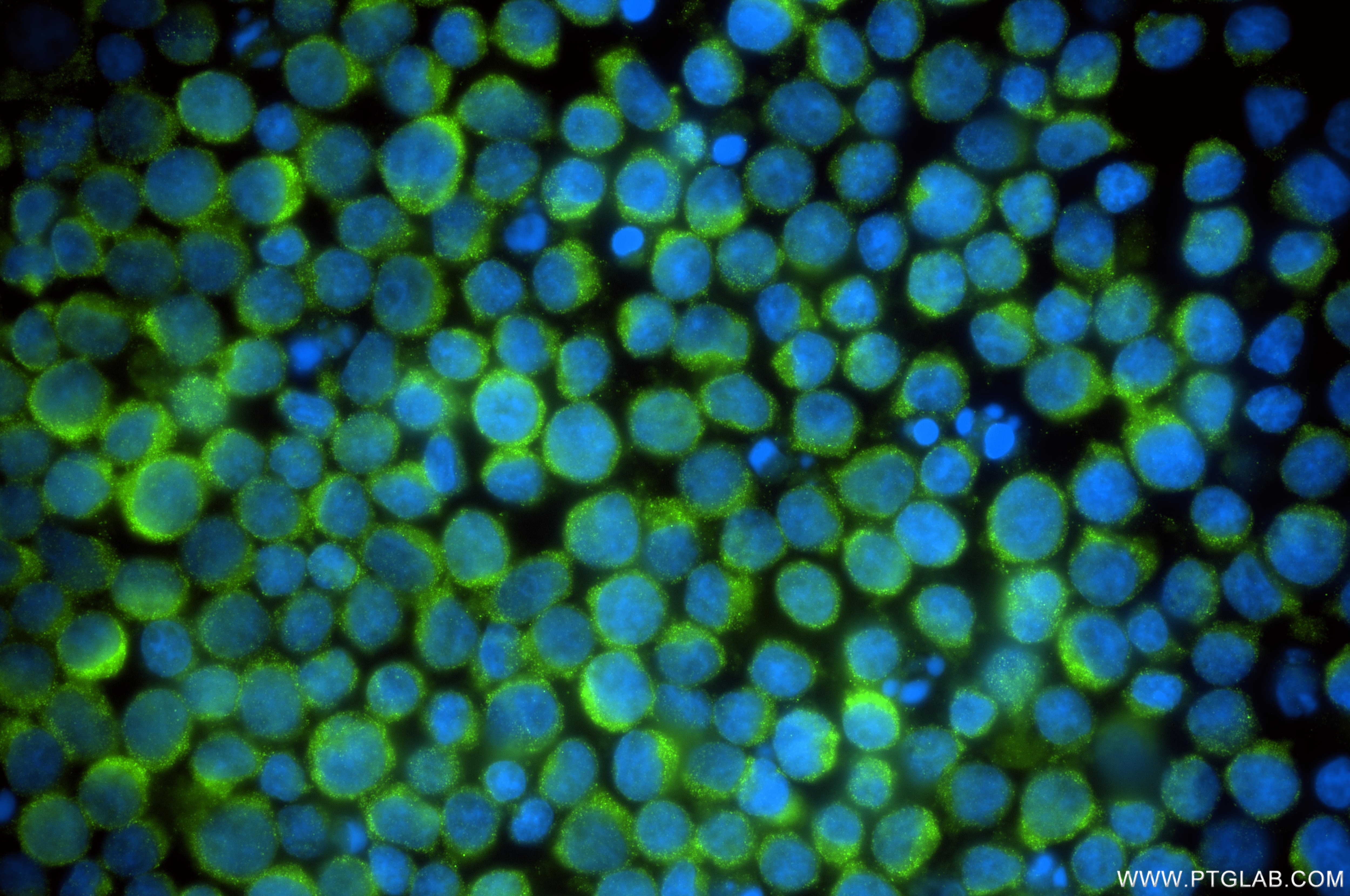 Immunofluorescence (IF) / fluorescent staining of Jurkat cells using CNOT8 Recombinant monoclonal antibody (86091-1-RR)