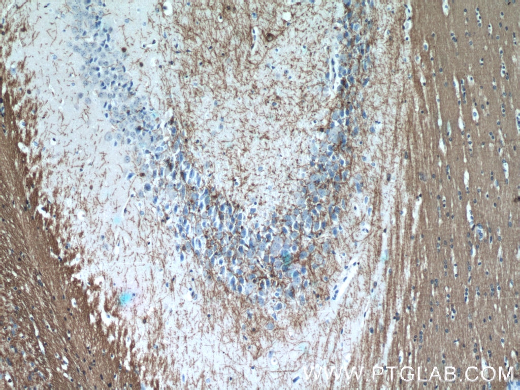 Immunohistochemistry (IHC) staining of mouse brain tissue using CNPase Polyclonal antibody (13427-1-AP)