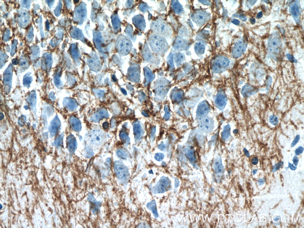Immunohistochemistry (IHC) staining of mouse brain tissue using CNPase Polyclonal antibody (13427-1-AP)
