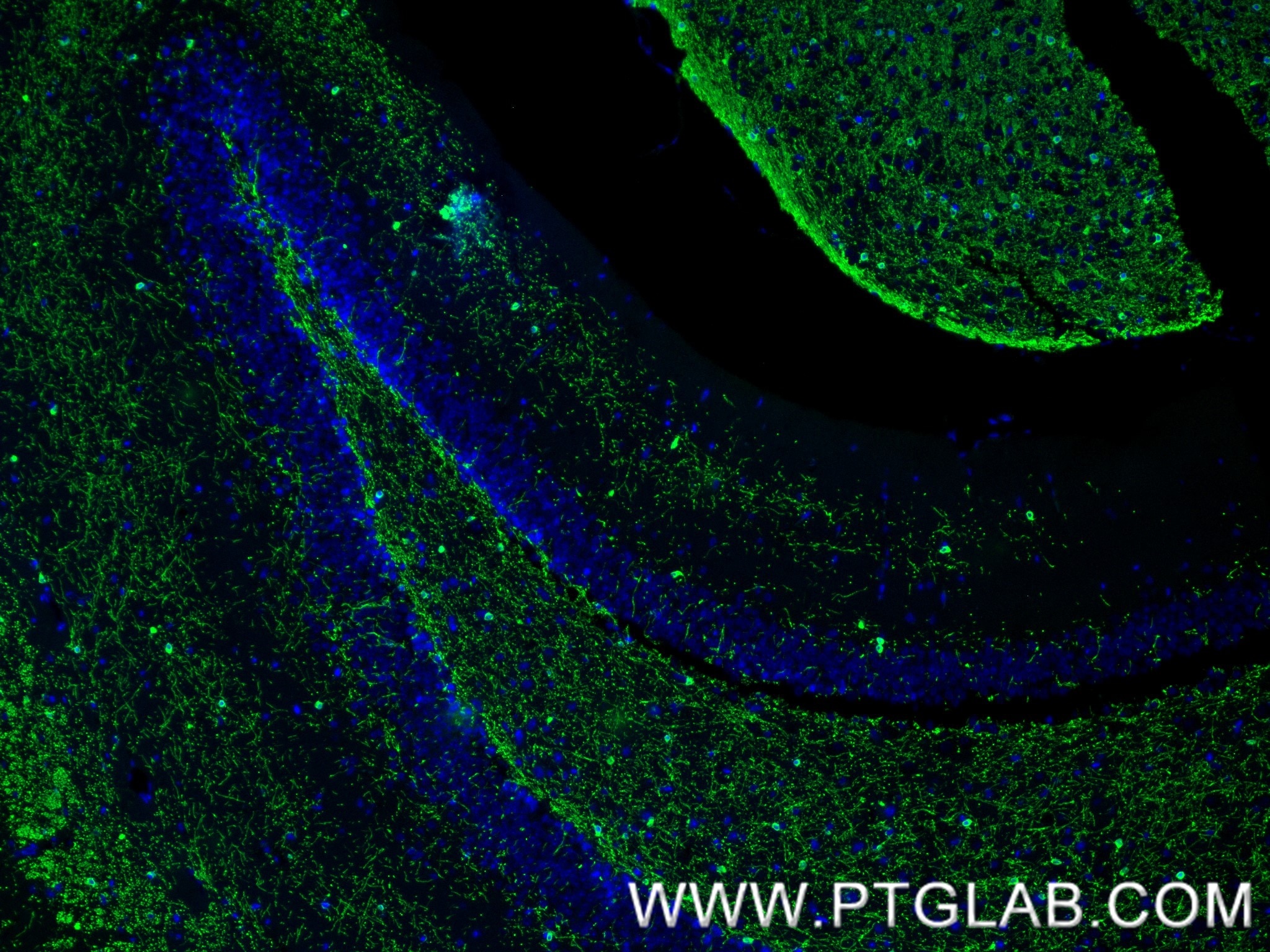 IF Staining of mouse brain using 86967-4-RR (same clone as 86967-4-PBS) Immunofluorescence (IF) / fluorescent staining of mouse brain tissue using CNPase Recombinant monoclonal antibody (86967-4-RR)