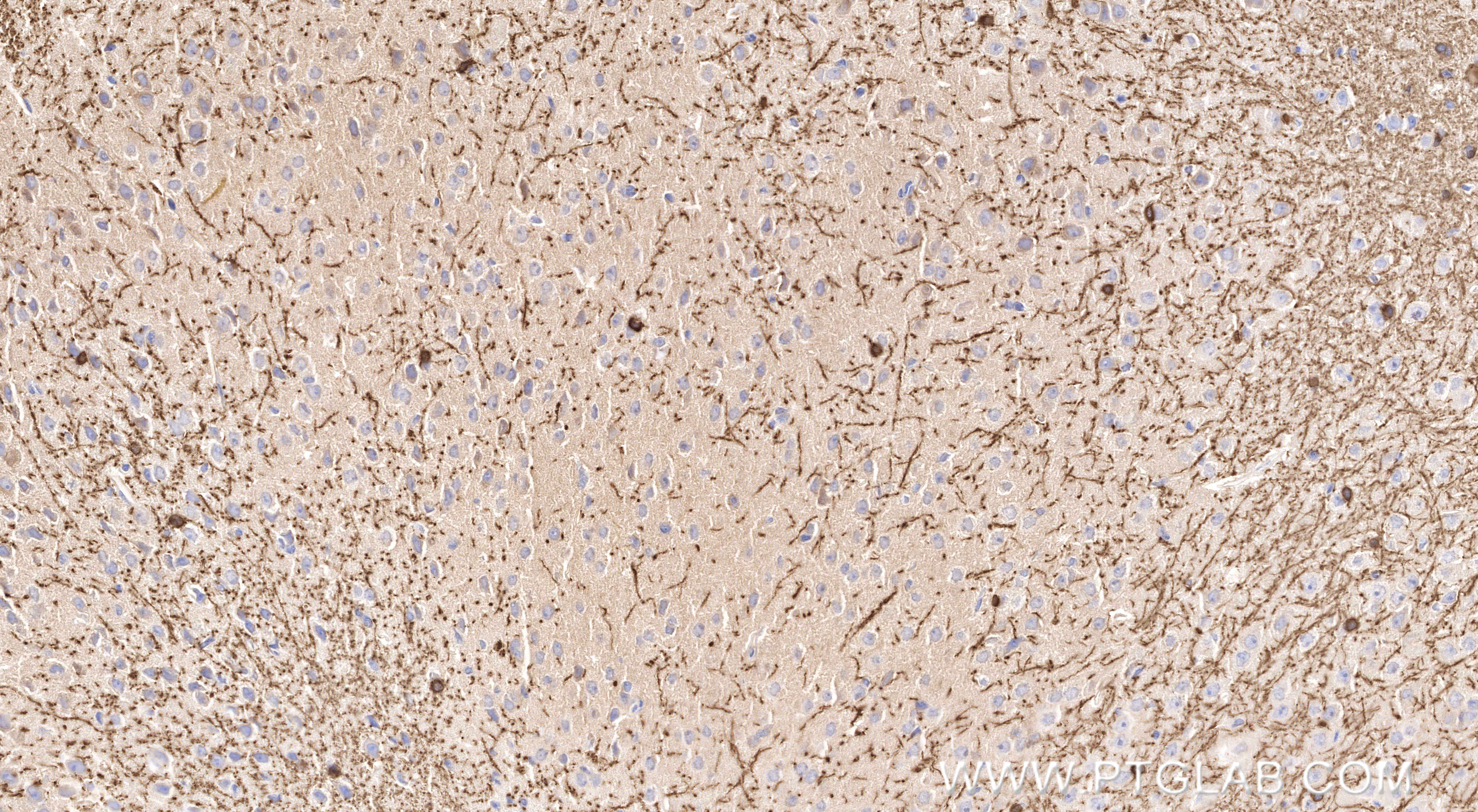 IHC staining of mouse brain using 86967-4-RR (same clone as 86967-4-PBS) Immunohistochemistry (IHC) staining of mouse brain tissue using CNPase Recombinant monoclonal antibody (86967-4-RR)