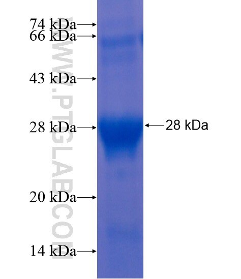 CNPY1 fusion protein Ag21160 SDS-PAGE