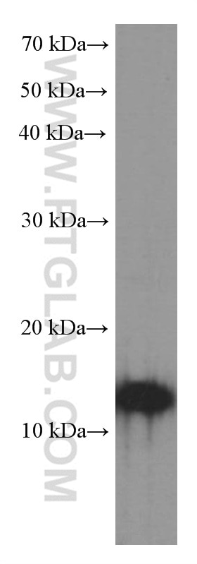 Western Blot (WB) analysis of rat liver tissue using CNPY2, MSAP Monoclonal antibody (66173-1-Ig)