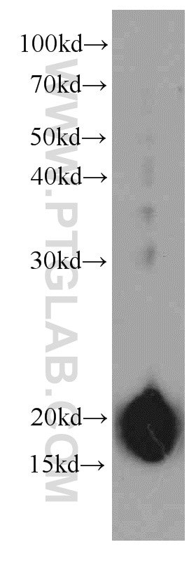 Western Blot (WB) analysis of human placenta tissue using CNPY2, MSAP Monoclonal antibody (66173-1-Ig)