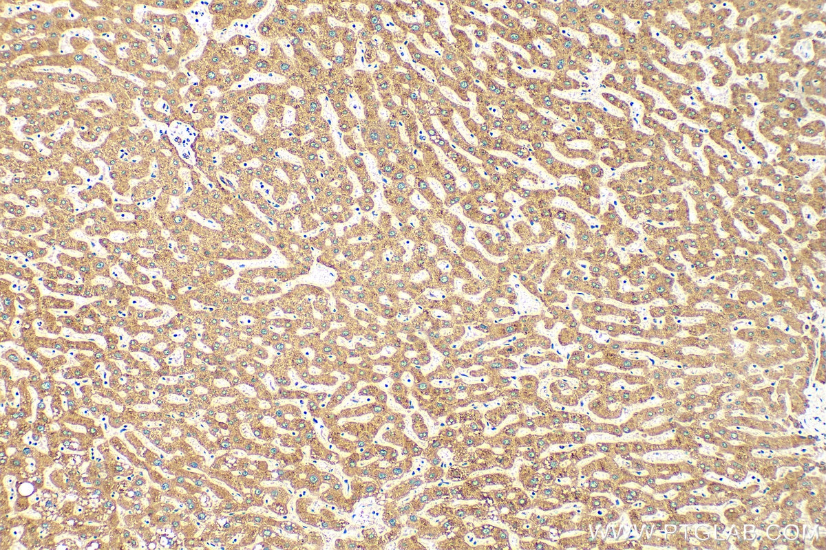 IHC staining of human liver using 14635-1-AP